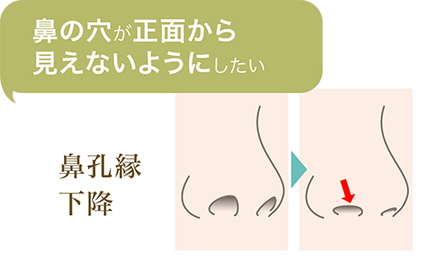 鼻の穴が正面から見えないようにしたい