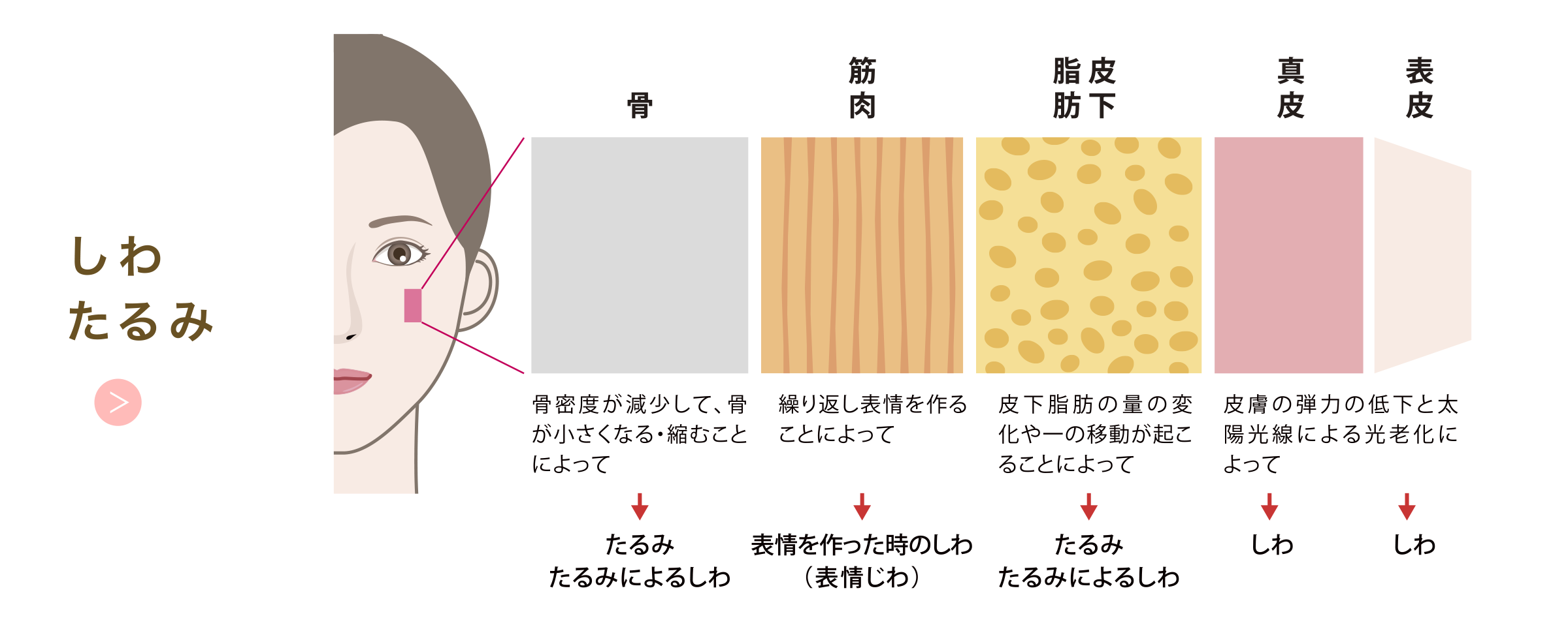 しわ・たるみ