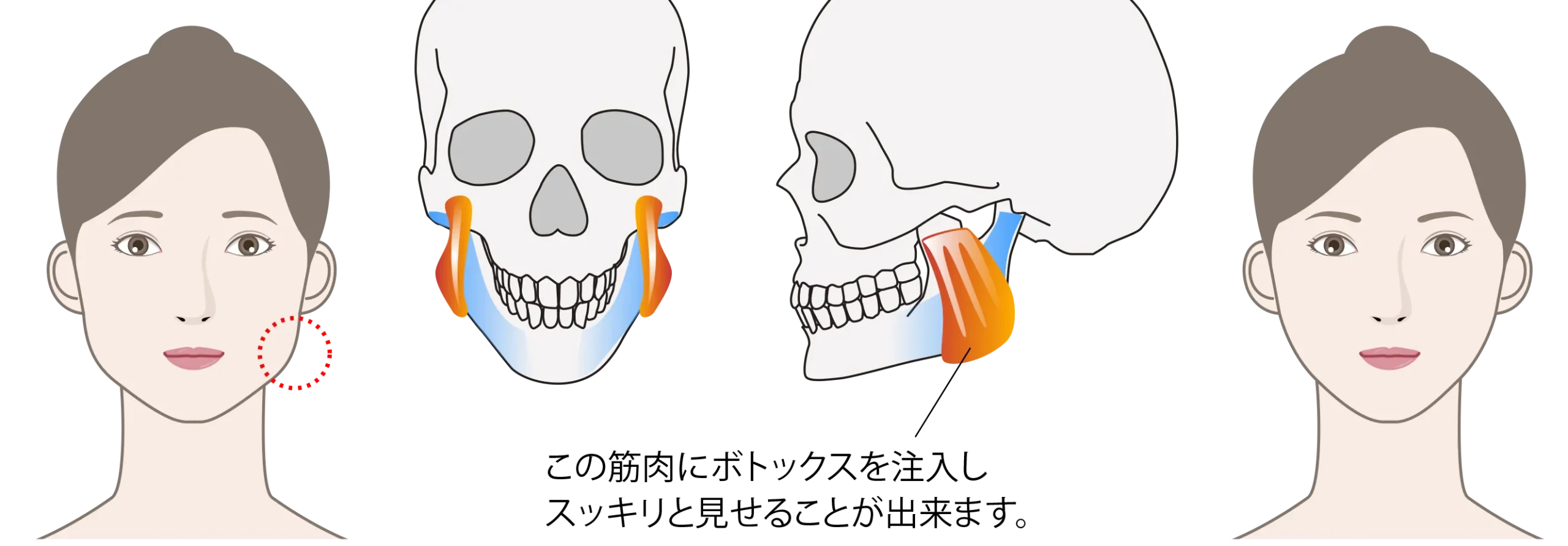 defined_jawline